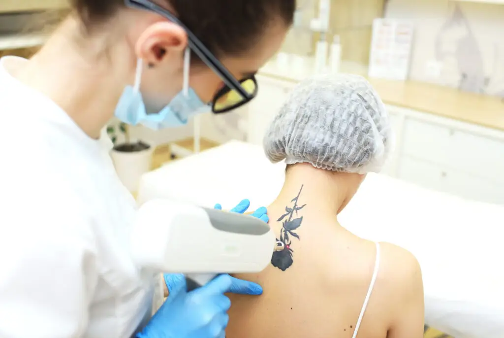 Can You Get Laser Hair Removal Over a Tattoo in Tampa?